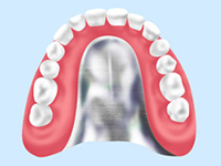 自費の入れ歯