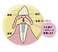 磁性アタッチメント
