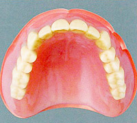 レジン床義歯【保険診療】