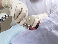 歯周外科（再生療法）